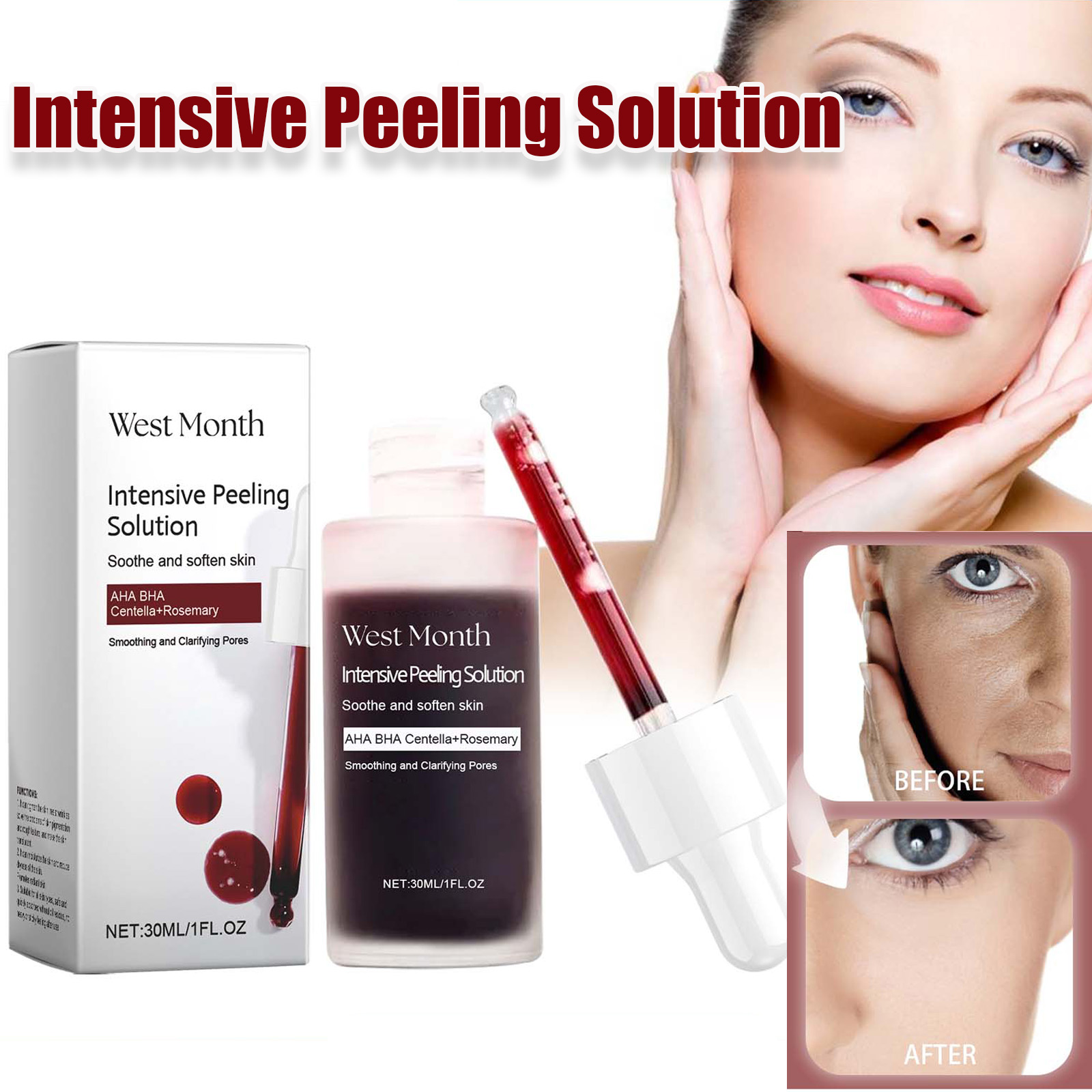 Azelaic Acid Serum - Suero Facial exfoliante antiacné, iluminador, exfoliante,